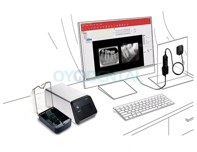 Handy HDS-500 PSP Scanner Digitale Fosforplaatscanner voor Tandheelkundige Beeldvorming